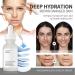 Niacinamide10%+Zinc 1% Face moisturizer Pore Reducer Face Serum Tackles Blemishes Niacinamide Serum for Blemish-Prone Dull Skin Softens Balancing Sebum Production Hydrating Serum (1) - Buy Online on GoSupps.com