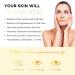 AZURE Vitamin C Under Eye Pads - Anti-Aging Lifting & Moisturizing Mask Patches - Reduces Fine Lines, Dark Circles & Puffiness - 5 Pairs - Buy Online on GoSupps.com