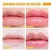 Bee Lip Balm Set: Hydrating Honey Pot Lip Mask with Propolis for Dry, Cracked Lips - 2 Pcs - Buy Online on GoSupps.com