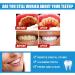 Tooth Whitening Gel & Essence Pen - Intensively Lighten Teeth Reduce Yellowing and Repair Gums - 1PC - Buy Online on GoSupps.com