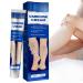 Varicose Veins Cream  Varicose Veins Treatment for Legs  Natural Varicose & Spider Veins Treatment  Strengthen Capillary Health  Improve Blood Circulation  Relieve Tired and Heavy Legs-20g