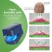 Home-Use Nail Fungus Laser Device with LED Blue Light Therapy - Buy Online on GoSupps.com