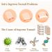 102Pcs Ingrown Toenail Kit Ingrown Toenail Corrector for Ingrown Toenail Treatment Including 80 PCS Ingrown Toenail Corrector 20 PCS C Shape Filling Pad and 2 Styles Ingrown Toenail Tools - Buy Online on GoSupps.com