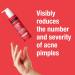 Stubborn Blackheads Daily Cleanser AHA Salicylic Acid Acne Treatment Glycolic + Mandelic + Polyhydroxy Acids Fragrance Free - Buy Online on GoSupps.com