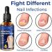 German Toenailcare Removal Paronychia Oil Care Oil for Removing Paronychia Toenail Treatment Best Nail Repair Solution Nail Renewal Liquid for Damaged & Discoloration Nail (3pcs) - Buy Online on GoSupps.com