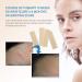 Aroamas Silicone Scar Removal Sheets 4 pcs White Professional, Drug-Free Solution for Burn, Keloid, Acne, Surgery Scars Soft Adhesive Fabric Strips, 2 Month Supply - Buy Online on GoSupps.com