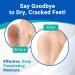 Dermal Therapy Heel Care Cream - 25% Urea & 6% AHA for Dry Cracked Heels | 8 oz | Packaging May Vary - Buy Online on GoSupps.com