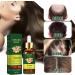 Ginger Oil Hair Growth Natural Hair Density Essential Oil Skin 100% Pure Essential Oil Aromatherapy Repair Skin Hair Growth Oil Strengthens Hair (Ginger 30 ml) B - Buy Online on GoSupps.com