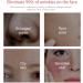 Mousse Nettoyante Visage 5 En 1: Nettoie Les Pores Profondeur Att nue Marques D'acn limine Points Noirs Contr le Le S bum Et Illumine La Peau(2PCS) - Buy Online on GoSupps.com