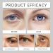  ZLHHRZJX Freshgaze Eye Contour Balm Stick with Vitamin C and Collagen - Eye Contour Balm with Retinol and Collagen Moisturizing Eye Contour Cream with Retinol in Stick (8 PCS) - Buy Online on GoSupps.com