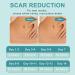Silicone Scar Removal Tape for Acne, C-Section & Surgery Scars - 2 Rolls, 6-12 Month Supply, 1.6 x 60 Per Roll - Buy Online on GoSupps.com