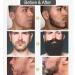 Beard Oil Spray Beard Growth Oil For Men Natural Formula Beard Growth Serum Nourishing Promote Beard Facial Hair Regrowth Mens Beard Oil Spray Moisturizes Softens&Strengthens Beard Care For Men - Buy Online on GoSupps.com