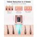 ZKMAGIC IPL Laser Hair Removal Device - Painless & Long Lasting with Ice Cooling Technology, 5 Levels & 2 Flash Modes for Full Body Use at Home - Rose - Buy Online on GoSupps.com