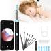 AVM Ear Wax Removal 3.6mm 1296p HD Wireless Pocket LED Ear Camera Earwax Removal with 8 Earwax Cleaner Kit for Kids Adults Pet for iPhone Android Phone and Tablet(Black) YY10ERB