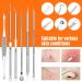 2023 Professional Blackhead & Pimple Popper Tool Kit | 15 PCS Acne Extractor Set with Metal Case - Stainless Steel Blemish Removal Tools - Buy Online on GoSupps.com