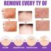Skin Tag Mole Removal 30ML - Natural Wart Remover & Corrector for Face and Body - Buy Online on GoSupps.com