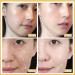 Gold Face Serum - Anti-Aging & Moisturizing Skincare with Soluble Protein Thread & Nano-Gold Essence | Active Collagen & Silk Thread Lifting - Buy Online on GoSupps.com