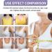 EKENOZ PlumpUpMore Peptide Protein Breast Enhancement Patch - Korean Breast Firming Patch for Sagging - 1Pcs - Buy Online on GoSupps.com