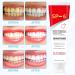 2 Pcs Sp-6 Fresh Breath Toothpaste Sp-6 Toothpaste Probiotic Toothpaste Sp-6 Toothpaste Sp-6 Ultra Whitening Sp-6 Toothpaste Sp-6 Fresh Breath Toothpaste Probiotic Toothpaste Sp-6 - Buy Online on GoSupps.com