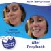 Temptooth: #1 Trusted Patented Temporary Tooth Replacement - Buy Now! - Buy Online on GoSupps.com