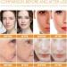 60ML 10% Niacinamide Serum + 1% Zinc Serum Niacinamide Moisturiser Control Excess Oil and Redness Serum Brightening Serum Dark Spot Remover Skin Tightening Cream Anti Aging & Wrinkle Face Serum - Buy Online on GoSupps.com