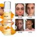 AILKE Natural Turmeric Face Toner Brightening Hydrating Rejuvenate Skin Acne & Pimples Removal Clean Skin With Vitamin C For All Skin Types 3.52 fl oz (Pack of 1) - Buy Online on GoSupps.com