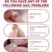 5g Nail Repair Gel for Cracked and Broken Nails - Instant Nail Treatment Kit - Buy Online on GoSupps.com