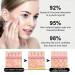 Banana Eye Cream Anti Aging Eye Cream for Fine Lines Eye Bags Dark Circles and Puffiness Hydrating Under Eye Cream with Retinol Vitamin E Vitamin C Skin Care & Lifts(2PCS) - Buy Online on GoSupps.com