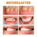 Repair Ampoules Removing Tartar And Plaque And Various Oral Problems 10.5ml - Buy Online on GoSupps.com