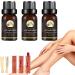 Japagzy Marrony Oil for varicose veins vein healing varicose veins treatment spray veins mois varicose veins for legs treatment 10 ml 3box