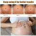Stretch Mark Cream Prevention Stretch Mark Cream Skin Hydration Whitening Specialized Care for Stretch Marks Dry Skin and Irregular Skin Fragrance Free - Buy Online on GoSupps.com