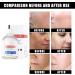 Aobenz Spot Remover for Face Dark Spots Remover Aobenz Dark Spot Correcting Serum Brightening Serum Dark Spot Remover for Face Freckle Remover Dark Spot Correcting Glow Serum - Buy Online on GoSupps.com