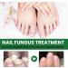 MrCuvaryas Nail Serum for Toenails Extra Strong - Buy Online on GoSupps.com