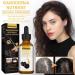 EPMANN DARKA Anti-Greying Hair Serum - Organic Ganoderma Nutrient, Reverse Grey Hair Naturally - 1 Fl Oz (Pack of 2) - Buy Online on GoSupps.com