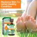 TUHIMO Corn Remover for Feet and Toes - Callus and Corn Removal Treatment - Buy Online on GoSupps.com