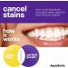 AquaSonic Perfect Purple Teeth Whitening Serum | Color-Correcting | Neutralize Yellow Stains | Mint Flavor | Order Internationally - Buy Online on GoSupps.com