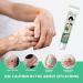 Vitiligo Care Cream - Natural Treatment for Skin Pigmentation | Reduce White Spots, Improve Skin Tone - Buy Online on GoSupps.com