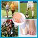 Kimihome Silicone Toe Protective Caps - 16 Pieces for Corns Blisters & Ingrown Toenails | Size Options: Small Medium Large - Shop Internationally - Buy Online on GoSupps.com