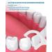 Netonda 200 PCS Gentle Dental Insult for Sensitive Gums | Fluffzen Fluff-Tahnband for Pain-Sensitive Teeth - Ideal for Dental Rooms - Buy Online on GoSupps.com