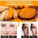 Turmeric Face Serum - Dark Spot Correcting Glow Serum with Turmeric Oil for Skin - Reduces Age Spots - Moisturzing Body & Face Oils and Serums. - Buy Online on GoSupps.com