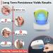 Nail Fungus Laser Treatment Device - Home Treatment for Healthy Nails and Toenails (White) - Buy Online on GoSupps.com