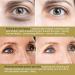 Augestpo Korean Micro-Darts Eye Rejuvenating Patches Pro - Dark Spot & Eye Bag Treatment Mask - Buy Online on GoSupps.com