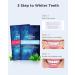 Teeth Whitening Strips 50 Pcs - Gentle & Safe Whitening Treatment, Non-Slip, Enamel-Safe, Removes All Stains - 25 Treatments - Buy Online on GoSupps.com