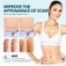 Metetas Advanced Scar Cream 1.7 Oz - Silicone Scar Gel for Surgical, C-Section, Stretch Marks, Keloids & Burns - Effective Treatment for Old & New Scars - 50ml - Buy Online on GoSupps.com