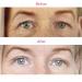 Eyelid Tape Invisible Eyelid Strips Droopy Eyelid Lifter Self-Adhesive Fiber Eyelid Correcting Strips for Droopy Hooded Mono-eyelids 280Count 5mm size 280Pcs 5MM One-sided sticky Red - Buy Online on GoSupps.com