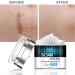 Scar Removal Cream - Repair & Moisturize Old/New Scars, for Male/Female, Surgery/Scald/Burns - 1.85 FL OZ - Buy Online on GoSupps.com