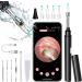 Zupora Ear Camera Ear Wax Removal Kit  Earwax Remover Tool 1920P FHD Wireless Ear Otoscope with LED Lights Ear Scope with Ear Wax Cleaner Tool for iPhone  iPad & Android Smart Phones Blown
