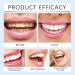 Smilefitpro Peinture de Blanchiment des Dents Vernis Dents Blanc Serr Instant Teeth Whitening Paint Instantan e Eliminer les Taches Oral de Blanchiment Portable Clean Brighten (2PC) - Buy Online on GoSupps.com