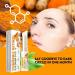 Lumistick For Eye Bags Lumibalm Eye Bags Turmeric Eye Cream Stick Eye Cream Stick For Reduces Fine Lines Eye Balm Stick Hydrating For Puffiness And Bags Reduces (3) - Buy Online on GoSupps.com