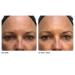 Algenist Blue Algae Vitamin C Peel - Dark Spot Corrector Exfoliating AHA/BHA/PHA Brighten & Even Skin Tone (45ml) - International Shipping Available - Buy Online on GoSupps.com